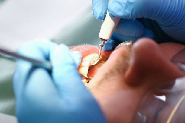 Best Emergency Tooth Extraction in Lagrange, GA